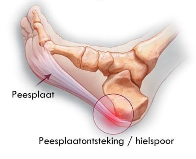 hielspoor